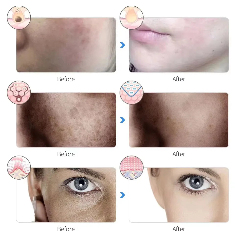 OFF MODE LED Facial Light Mask